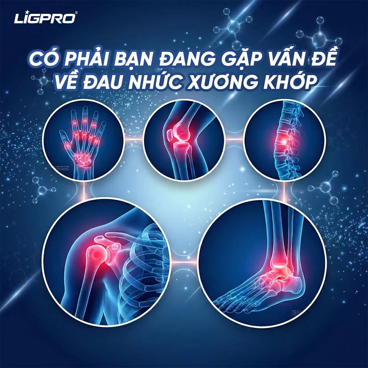 Gel Nóng Xoa Bóp Ligpro Giảm Đau Cổ Vai Gáy Giúp Thư Giãn Cơ 100ML